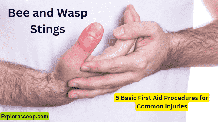an image of swalon thumb due to Bee or Wasp Stings (5 basic first aid procedures for common injuries
)