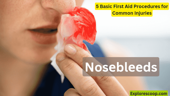 NoseBleed is common and there are 5 basic first aid procedure