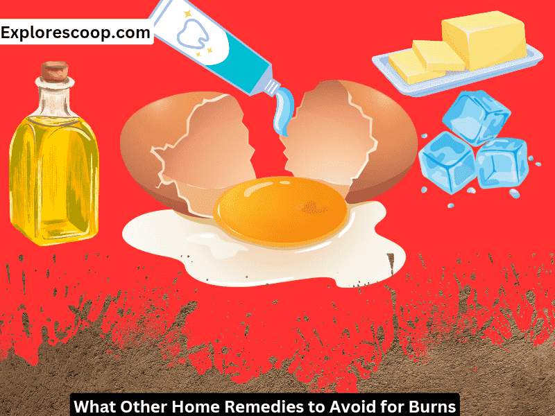 this image is showing what other home remidies to avoid-(does mustard help with burns)