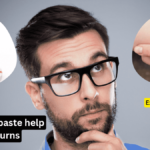 an image showing a man thinking about does toothpaste help with burns Debunk toothpaste on burns myth