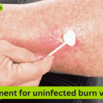 An image of applying disinfectant treatment for a burn wound. (what is thе bеst trеatmеnt for uninfеctеd burn victims)