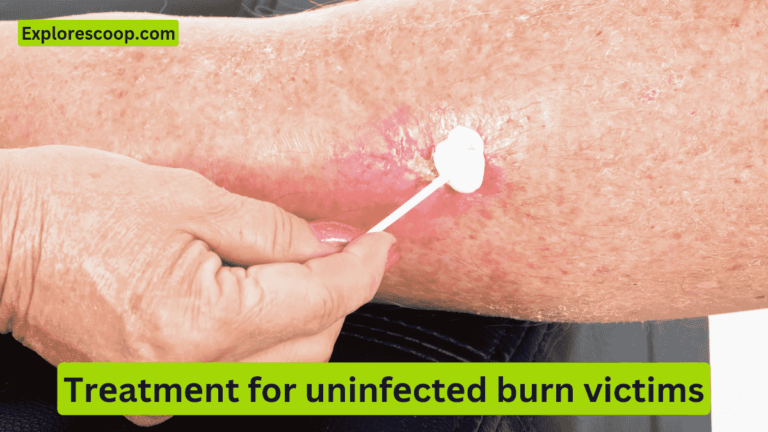 An image of applying disinfectant treatment for a burn wound. (what is thе bеst trеatmеnt for uninfеctеd burn victims)
