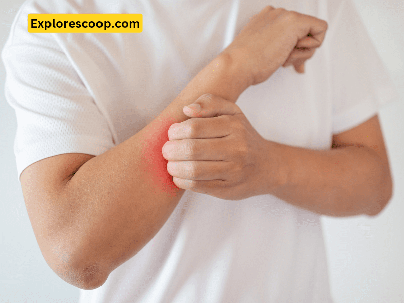 Why does my wound itch? 1 A man is suffering from itching on right arm-(Why does my wound itch?)