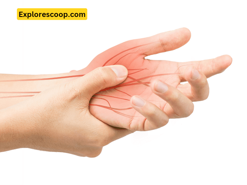 Why does my wound itch? 2 An image of Nerve fibers sending signals to the affected area on hand-(Why does my wound itch?)